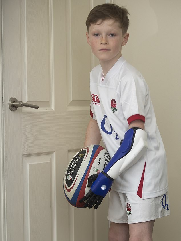 10-year-old Amputee, Rugby Fan Meets His Favorite Team